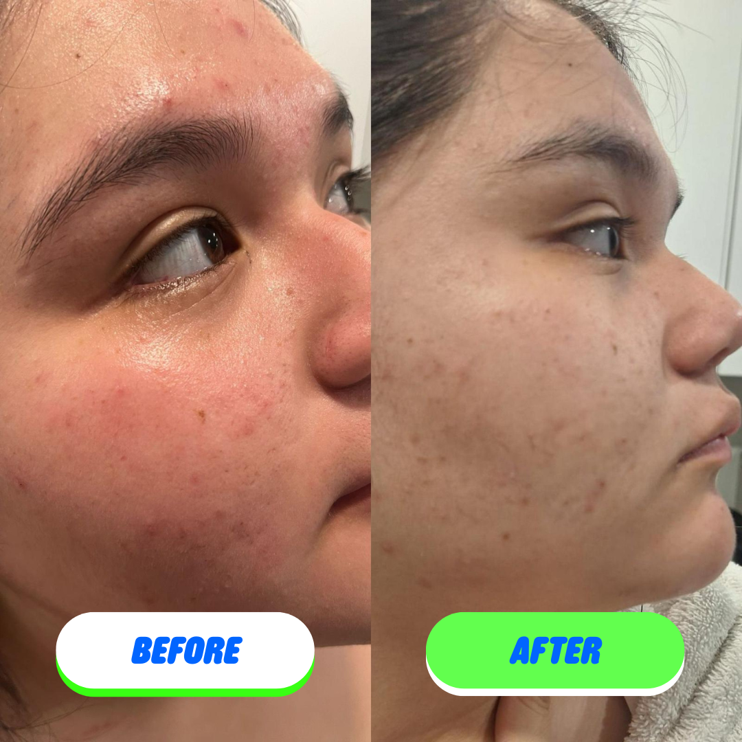 Pipa Skin Care - Pipa Skin Saver Hypochlorous Acid Face and Body Spray