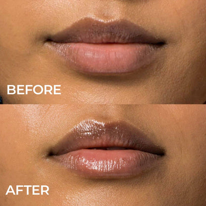 Indie Lee - Lip Remedy Mask