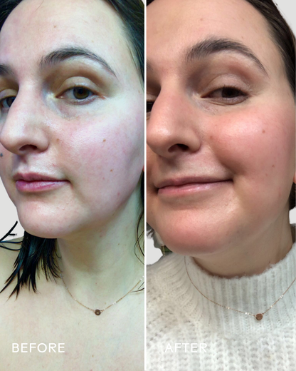 Three Ships SkinHero™ Calendula + 2% Bakuchiol Bio-Retinol Serum