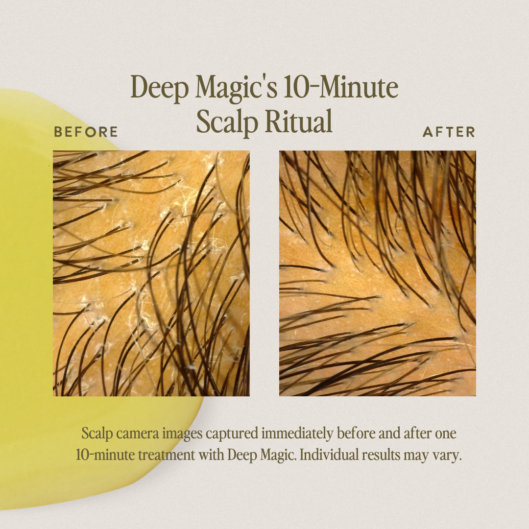 Deep Magic Hair + Scalp Serum by UNDER LUNA™