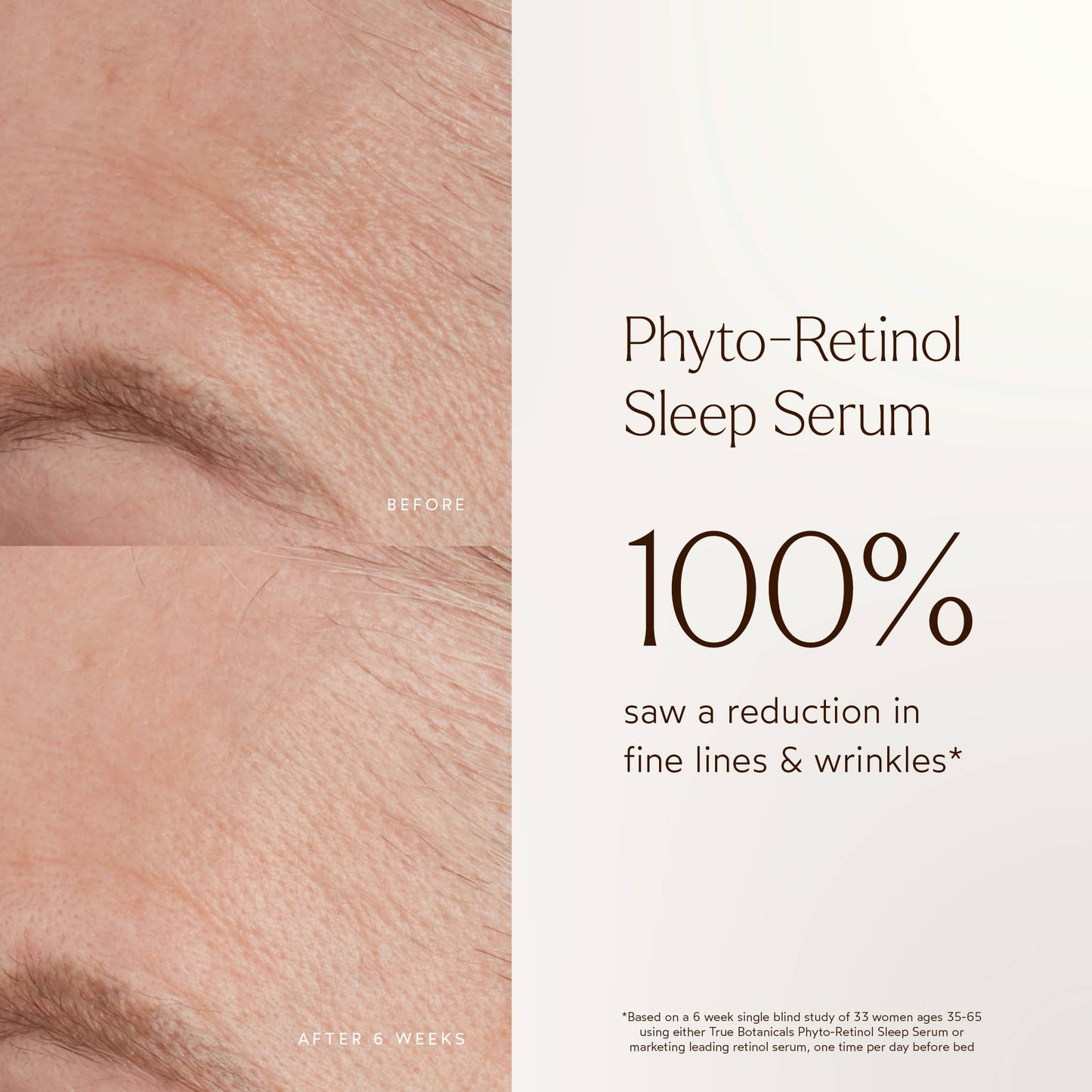 Phyto Retinol Anti-Aging Sleep Treatment