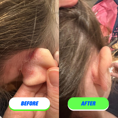 Pipa Skin Care - Pipa Skin Saver Hypochlorous Acid Face and Body Spray