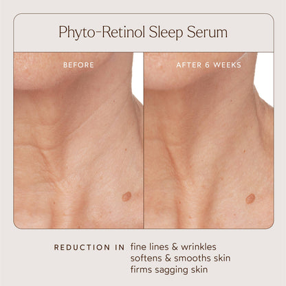 Phyto Retinol Anti-Aging Sleep Treatment