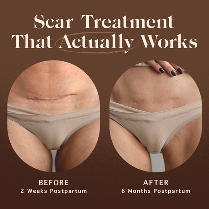 Renewing Scar Cream by Nemah